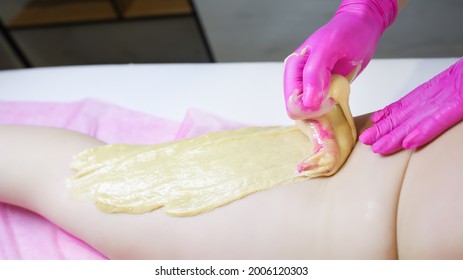 The Master Of Sugar Hair Removal Applies Sugar Paste To The Back Of The Thigh