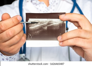 Masticatory Hypertrophy On The Right Side On Ultrasound Image Concept Photo. Doctor Indicating By Pointer On Printed Picture Of Ultrasound Pathology Masticatory Muscle Hypertrophy