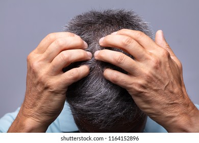 Mature Man With Dandruff Scratching His Head