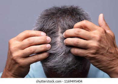 Mature Man With Dandruff Scratching His Head