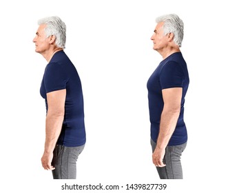 Mature Man With Poor And Good Posture On White Background