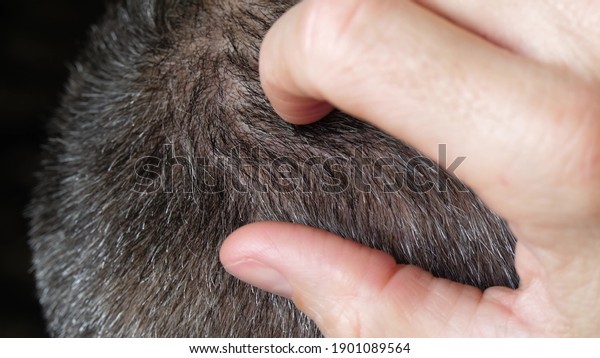 A mature man touches the scalp. Close-up of gray\
hair. Care and hair care products. The impact of stress and the\
environment on human health.
