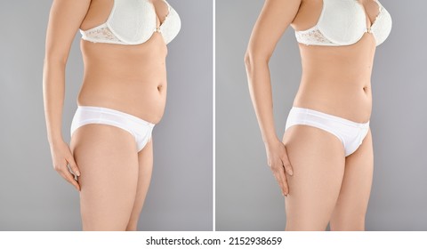 Mature Woman Body Before And After Liposuction. Plastic Surgery Concept.