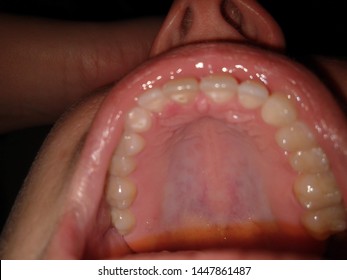 Hard Palate Images Stock Photos Vectors Shutterstock
