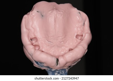 a maxillary alginate impression routinely requires
