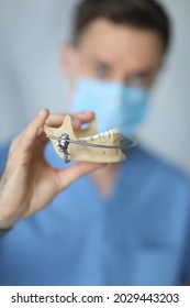 The Maxillofacial Surgeon Holds The Prosthesis