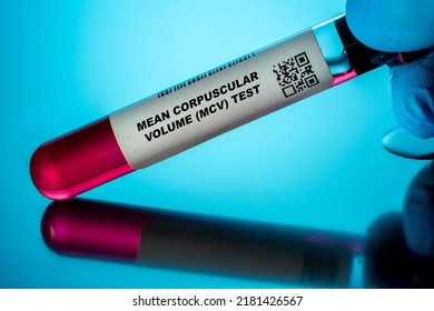 Mean Corpuscular Volume (Mcv) Test Blood Tests For Older Adults. Recommended Blood Test For The Elderly