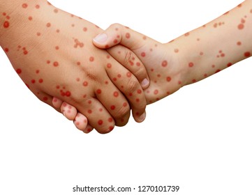 Contagious Diseases Images, Stock Photos & Vectors ...