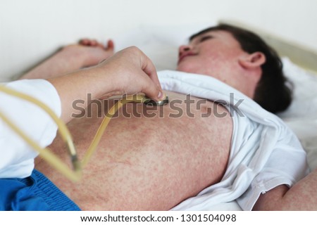 Measles rash. Child with allergy rush. Doctor and patient