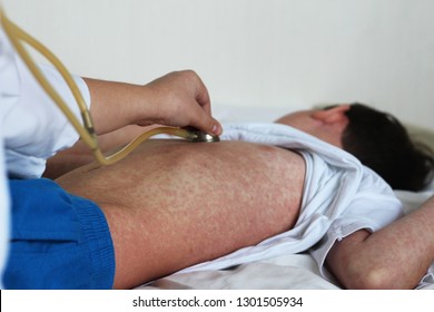 Measles Rash. Doctor And Patient