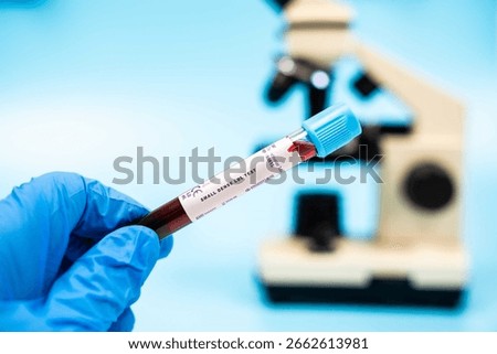 Measures small dense LDL particles, associated with increased cardiovascular risk. blood test in lab