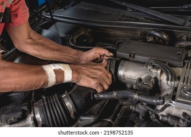 A Mechanic With An Injured Wrist And Forearm Detaches The Engine Intake Air Duct With His Bare Hands. At An Auto Repair Shop.