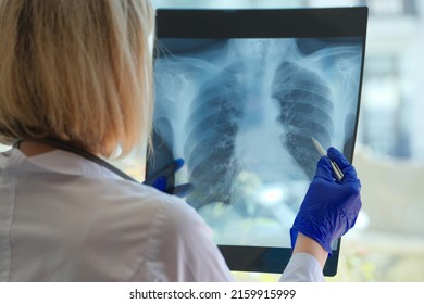 Medical Assistant Or Radiologist Holds Pointer For Examination And Training On Chest. Education And Prevention Of Tuberculosis And Concept Of Medical Surgery.