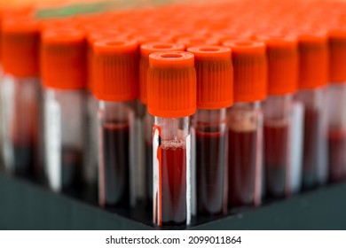 Medical Blood Diagnostic Technology Laboratory Blood Stock Photo ...