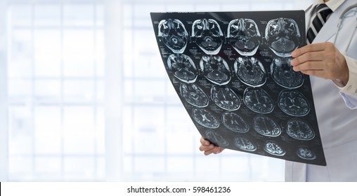 Medical Brain concept. radiology doctor check up x ray film of the brain patient by at hospital.