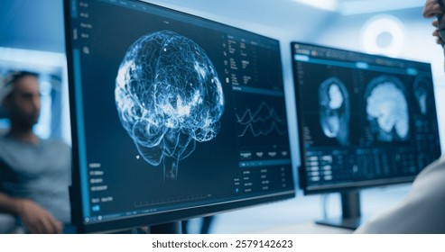 Medical Brain Scans on Multiple Computer Screens. Advanced Neuroimaging Technology Reveals Complex Neural Pathways, Display Showing CT Scan in a Modern Medical Environment