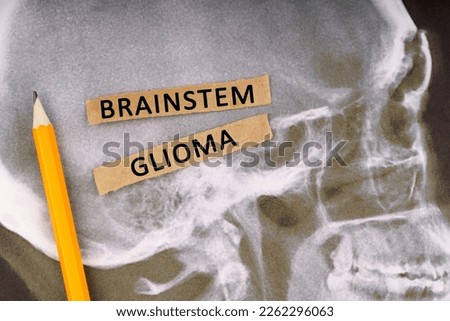 Medical concept. On x-rays of a human skull, a pencil and strips of paper with the inscription - Brainstem glioma