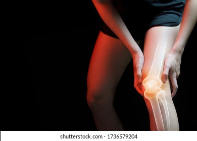 Medical concept, Woman suffering  with knee painful - skeleton x-ray, 