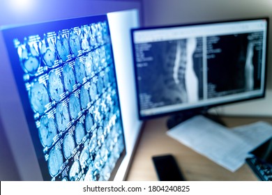 Medical CT Or MRI Or PET Scan Film On Computer Monitor. Technologically Advanced And Functional Medical Office.