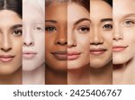 Medical and dermatological materials on skin conditions. Collage. Close-up of beautiful young girls of different nationality and skin colors. Concept of human diversity, beauty standards, cosmetics