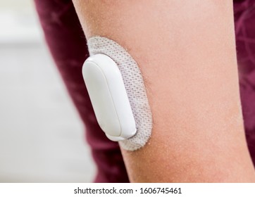 Medical Device For Glucose Check. Continuous Glucose Monitoring Pod. Modern Wireless Technology In Medicine.