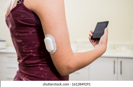 Medical Device For Glucose Check. Continuous Glucose Monitoring Pod. Modern Wireless Technology.