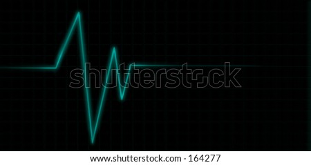 Medical heart monitor