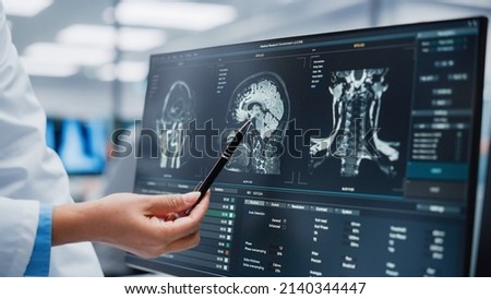 Medical Hospital: Neurologist and Neurosurgeon Talk, Use Computer, Analyse Patient MRI Scan, Diagnose Brain. Brain Surgery Health Clinic Lab: Two Professional Physicians Look at CT Scan. Close-up