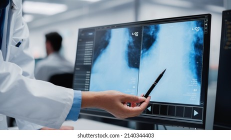 Medical Hospital: Two Doctors Talk and Use Computer, Point at Screen, Analysing Patient X-ray, Doing Test Results Analysis. Health Care Clinic Laboratory: Surgeon and Physician Finding Treatment - Powered by Shutterstock