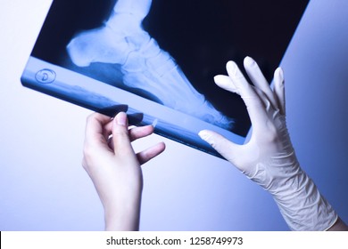 Medical Hospital Xray Feet Traumatology Scan Stock Photo
