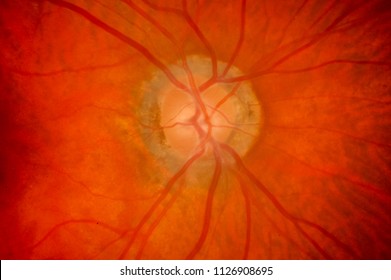 Medical Image Of Ocular Fundus, Human Retina