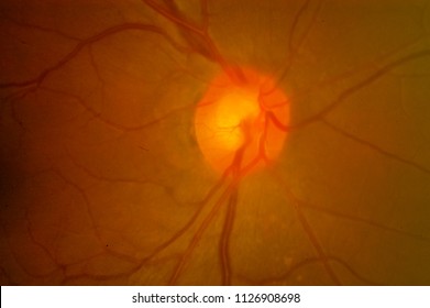 Medical image of ocular fundus, human retina