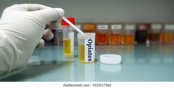Medical laboratory container with urine sample for drugs test benzodiazepine and opiates. Photo concept for determine presence of illegal drug  in urine in judicial or medical practice.