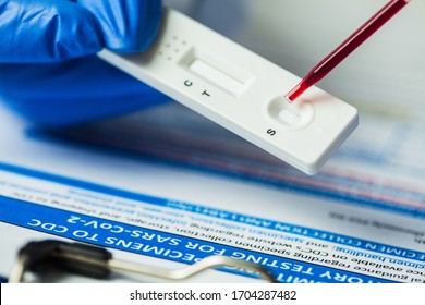 Medical laboratory NHS technician placing blood sample specimen on quick rapid diagnostic test using pipette,Coronavirus infected patient antibodies diagnosis,UK SARS-CoV-2 point of care fast testing