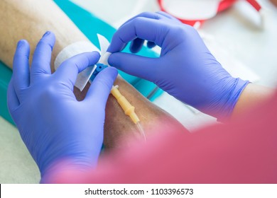 medical nurse with blue latex gloves inputs catheter to vein patient for drip of chemotherapy or another liquid medicine from cancer