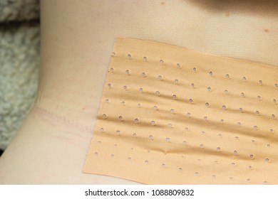 Medical Objects, Health Problems Concept. Closeup Of Heating Pad Plaster Bandage On Back