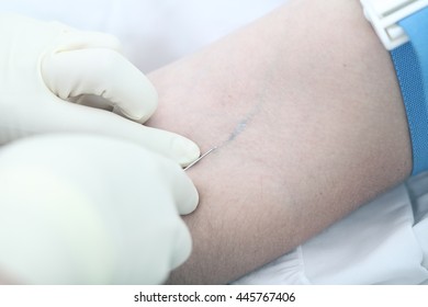 Medical Operation: Intravenous Injection. Close-up Photo