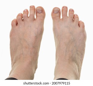 293 Second toe Images, Stock Photos & Vectors | Shutterstock