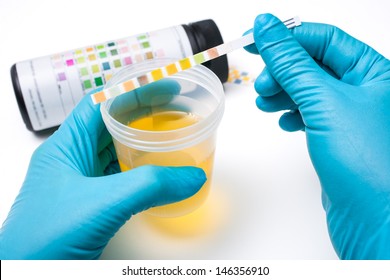 Medisinsk rapport og urin teststrimler