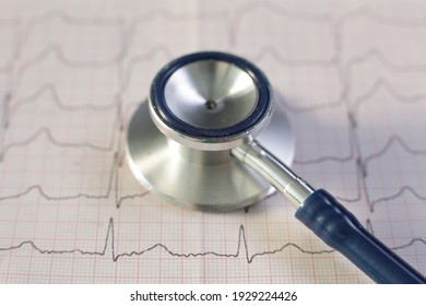 Medizinisches Stethoskop und Kardiogramm. Nahaufnahme