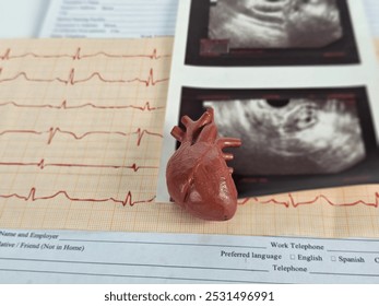 Medical study material with a model heart, ECG readings, and ultrasound images on a clinical document background - Powered by Shutterstock