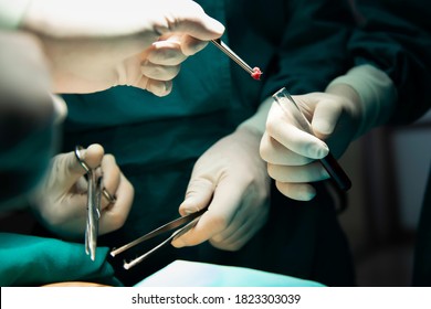 Medical surgery for removal the tissue of biopsy surgery will sent to pathology department. Surgical removal of pre-cancerous tissue in operating room.  - Shutterstock ID 1823303039