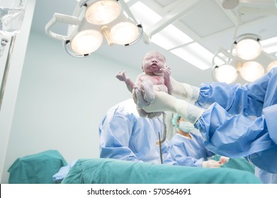 The medical team performing cesarean sections. The doctor hold the baby giving birth to his mother to see. - Powered by Shutterstock