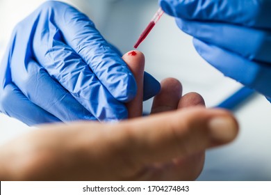 Medical technician EMS doctor taking finger prick PRP patient blood sample using pipette,Coronavirus COVID-19 global pandemic crisis outbreak,UK rapid strep diagnostic antibody testing procedure