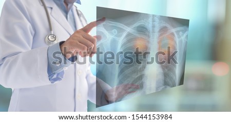medical technology lung radiography,Pneumonia concept. radiology doctor examining at chest x ray  of patient at hospital room.
