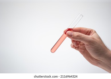 Medical Test Tube Containing A Light Pink Liquid Held In Hand By Caucasian Male. Close Up Studio Shot, Isolated On White Background.