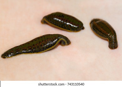 Medicinal Leech-hirudo medicinalis