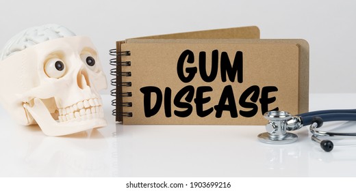 Medicine And Health Concept. On The Table Lies A Skull, A Stethoscope And A Notebook With The Inscription - GUM DISEASE