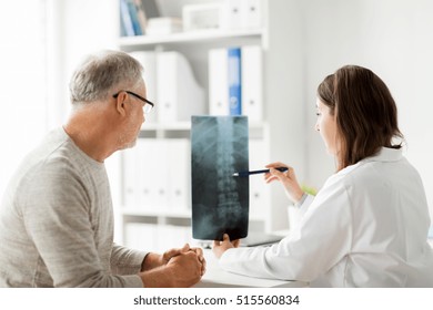 medicine, healthcare, surgery, radiology and people concept - doctor showing x-ray of spine to senior man at hospital - Shutterstock ID 515560834