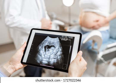 Medics with an ultrasound scan of unborn child on a digital tablet during an examination with a pregnant woman in the office, cropped view without faces - Powered by Shutterstock